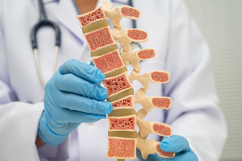 Doctor holding back bone model