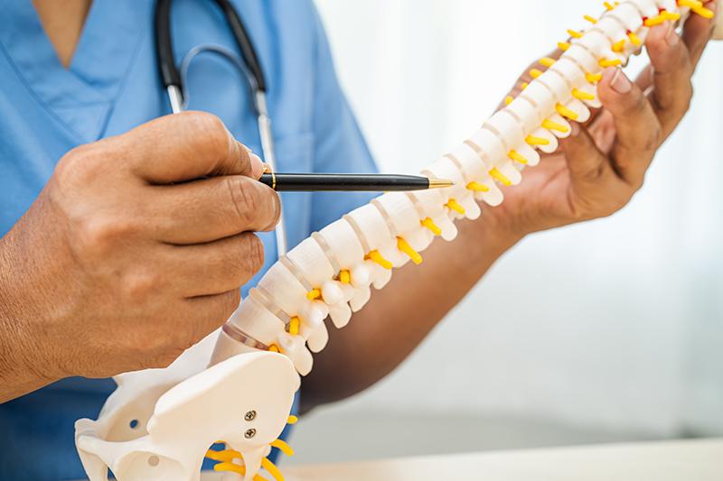 Doctor explaining spinal stenosis with a spine model.