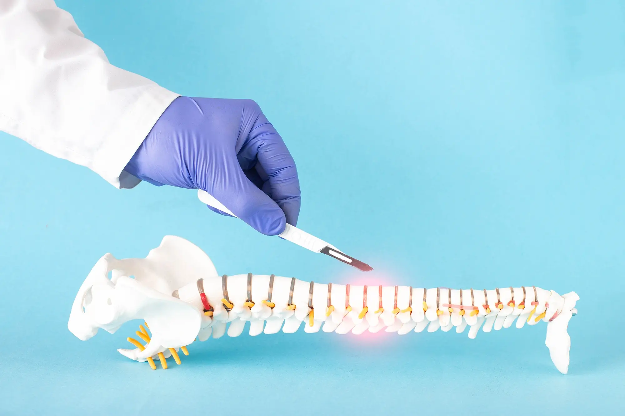 Why Keyhole Spine Surgery Matters for Today’s Spine Problems