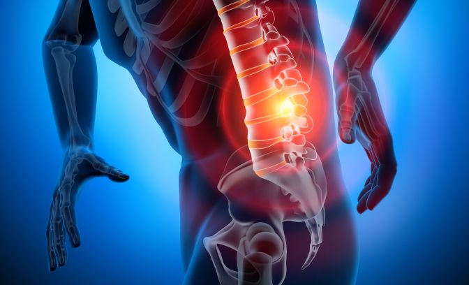 Orthopaedic illustration showing spine and lower back pain
