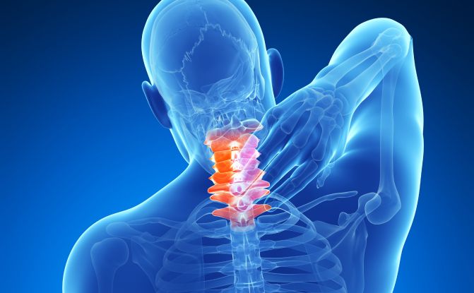 What is Neck Pain (Cervicalgia)?