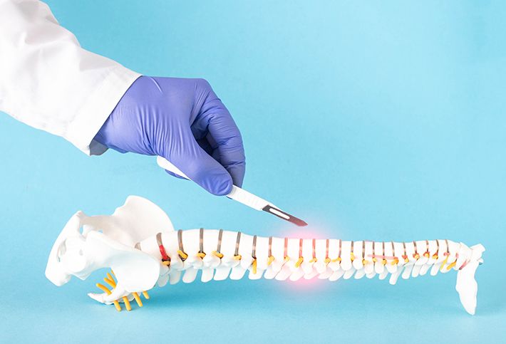 How to Prepare for Spinal Decompression Surgery